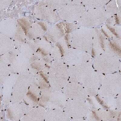 Immunohistochemistry-Paraffin: RPUSD4 Antibody [NBP1-82231]