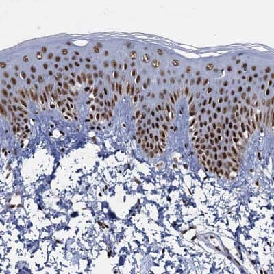 Immunohistochemistry-Paraffin: RPUSD4 Antibody [NBP1-82231]