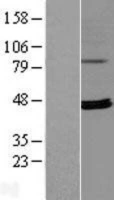 Western Blot: RPUSD4 Overexpression Lysate [NBL1-15583]