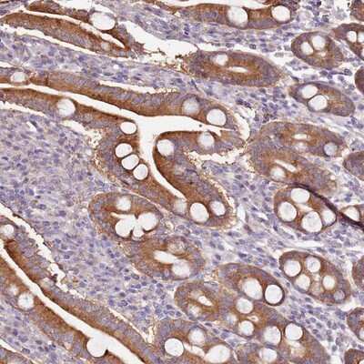 Immunohistochemistry-Paraffin: RQCD1 Antibody [NBP1-92354]