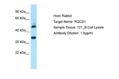 Western Blot: RQCD1 Antibody [NBP2-83475]