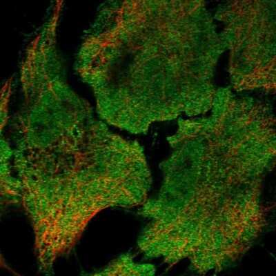 Immunocytochemistry/ Immunofluorescence: RRAD Antibody [NBP2-13266]