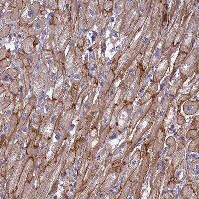 Immunohistochemistry-Paraffin: RRAD Antibody [NBP2-13266]