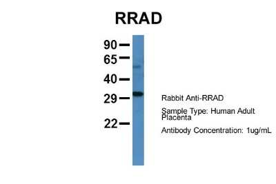 Western Blot: RRAD Antibody [NBP1-58864]