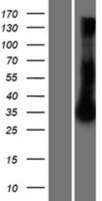 Western Blot: RRAD Overexpression Lysate [NBP2-07903]