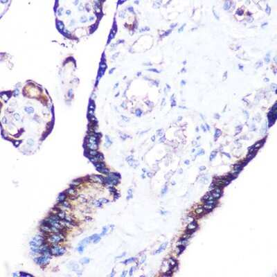 Immunohistochemistry-Paraffin: RRAGA Antibody - Azide and BSA Free [NBP2-94546]