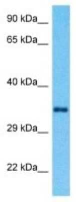 Western Blot: RRAGA Antibody [NBP3-09951]