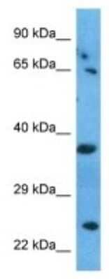 Western Blot: RRAGA Antibody [NBP3-09997]