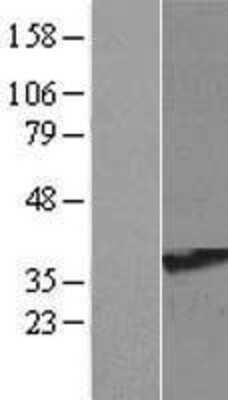 Western Blot: RRAGA Overexpression Lysate [NBL1-15585]