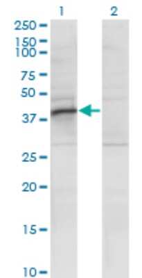 Western Blot: RRAGB Antibody (2B8) [H00010325-M01]