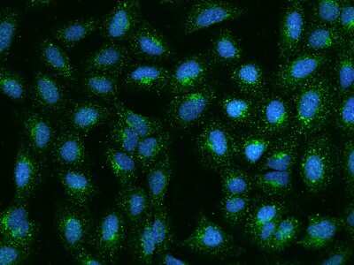 Immunocytochemistry/ Immunofluorescence: RRAGB Antibody [NBP2-97877]