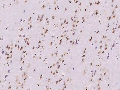 Immunohistochemistry-Paraffin: RRAGB Antibody [NBP2-97877]