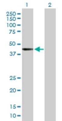 Western Blot: RRAGB Antibody [H00010325-B01P]