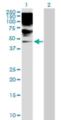 Western Blot: RRAGB Antibody [H00010325-D01P]