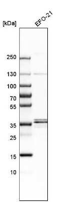 Western Blot: RRAGB Antibody [NBP1-85801]