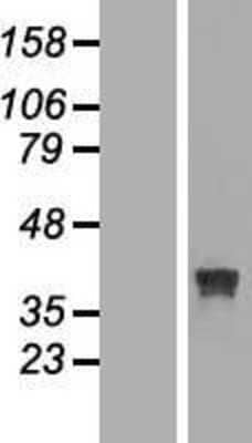 Western Blot: RRAGB Overexpression Lysate [NBL1-15586]