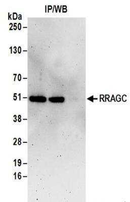 Immunoprecipitation: RRAGC Antibody [NBP2-32084]