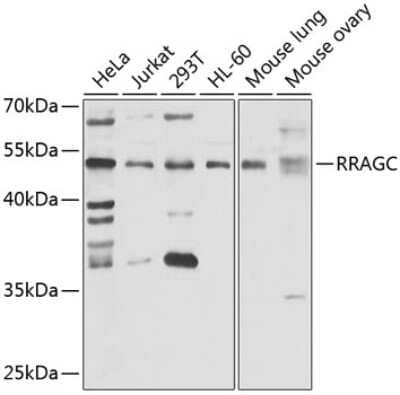 Western Blot: RRAGC AntibodyBSA Free [NBP2-93204]