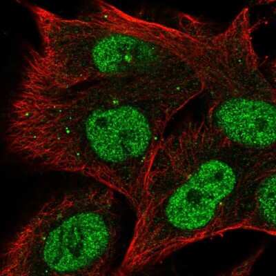 Immunocytochemistry/ Immunofluorescence: RRAGD Antibody [NBP2-55736]