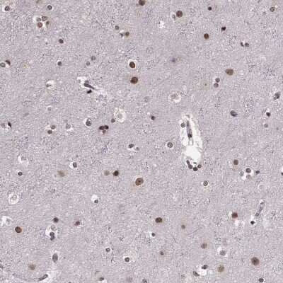 Immunohistochemistry-Paraffin: RRAGD Antibody [NBP2-55736]