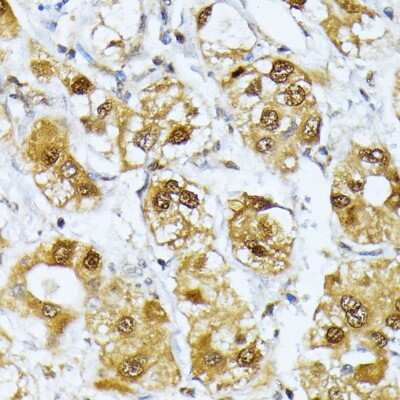 Immunohistochemistry-Paraffin: RRAGD Antibody - BSA Free [NBP2-93833]