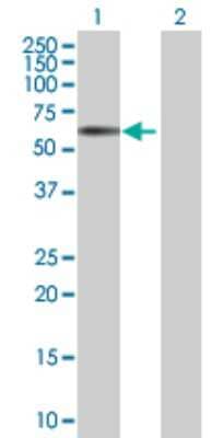 Western Blot: RRAGD Antibody [H00058528-B01P]