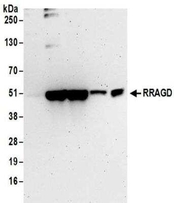 Western Blot: RRAGD Antibody [NBP2-32106]