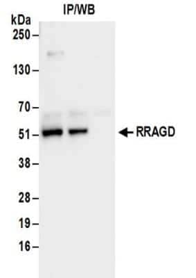 Western Blot: RRAGD Antibody [NBP2-32106]