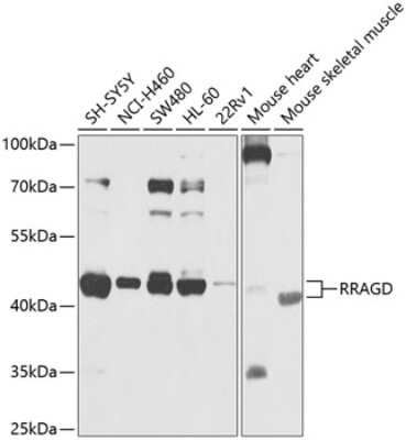 Western Blot: RRAGD AntibodyBSA Free [NBP2-93833]