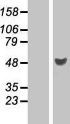 Western Blot: RRAGD Overexpression Lysate [NBP2-06538]