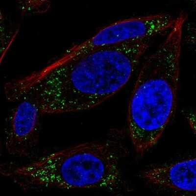 Immunocytochemistry/ Immunofluorescence: RRAS Antibody [NBP2-56964]