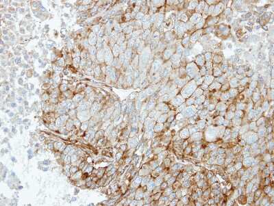 Immunohistochemistry-Paraffin: RRAS Antibody [NBP1-32156]