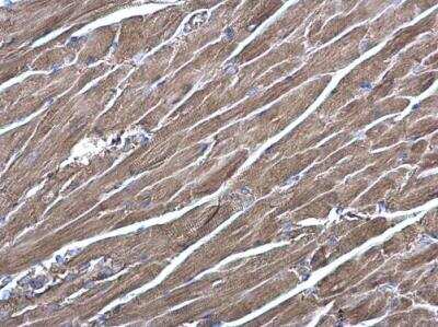 Immunohistochemistry-Paraffin: RRAS Antibody [NBP1-32156]