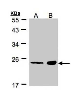 Western Blot: RRAS Antibody [NBP1-32156]