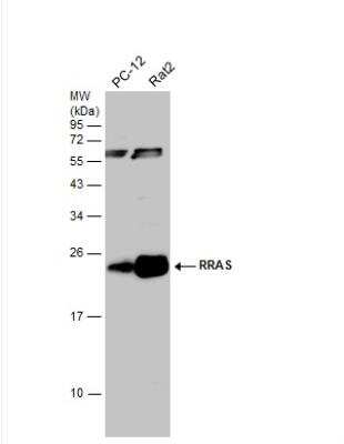 Western Blot: RRAS Antibody [NBP1-32156]