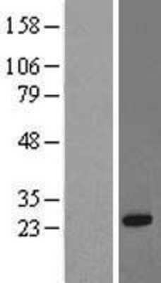 Western Blot: RRAS Overexpression Lysate [NBL1-15588]