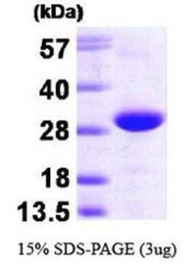 SDS-PAGE: Recombinant Human TC21/R-Ras2 His Protein [NBP1-30244]