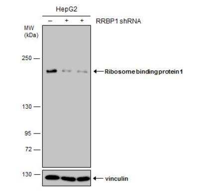 Western Blot: RRBP1 Antibody (1611) [NBP2-43668]