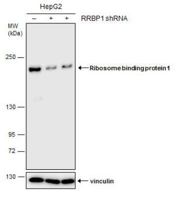 Western Blot: RRBP1 Antibody (5610) [NBP2-43600]