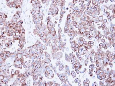 Immunohistochemistry-Paraffin: RRBP1 Antibody [NBP1-32813]