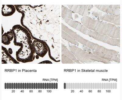 Immunohistochemistry-Paraffin: RRBP1 Antibody [NBP1-83957]