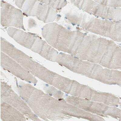 Immunohistochemistry-Paraffin: RRBP1 Antibody [NBP1-83957]