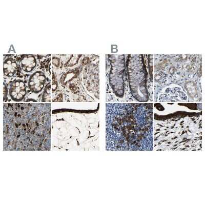 Immunohistochemistry-Paraffin: RRBP1 Antibody [NBP1-83957]