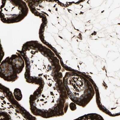 Immunohistochemistry-Paraffin: RRBP1 Antibody [NBP1-83957]