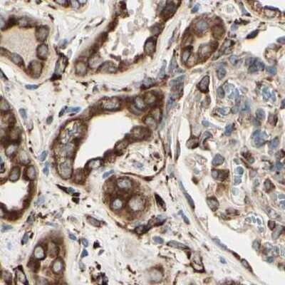 Immunohistochemistry-Paraffin: RRBP1 Antibody [NBP1-83957]