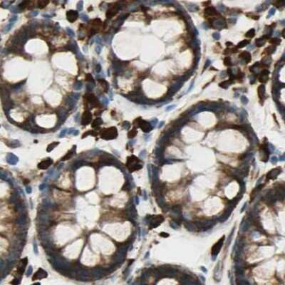 Immunohistochemistry-Paraffin: RRBP1 Antibody [NBP1-83957]