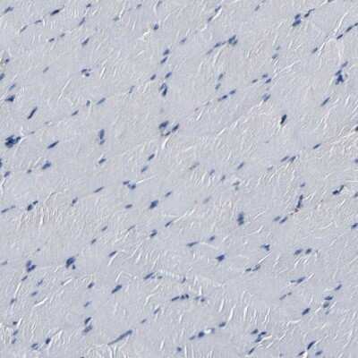 Immunohistochemistry-Paraffin: RRBP1 Antibody [NBP1-83958]