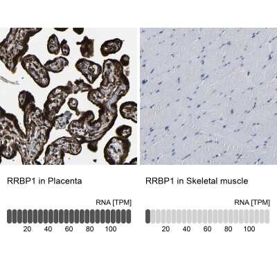 Immunohistochemistry-Paraffin: RRBP1 Antibody [NBP1-83958]