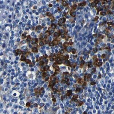 Immunohistochemistry-Paraffin: RRBP1 Antibody [NBP1-83958]