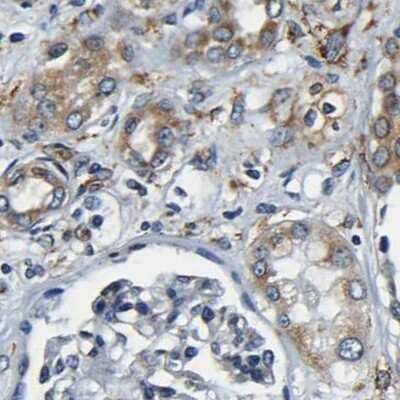 Immunohistochemistry-Paraffin: RRBP1 Antibody [NBP1-83958]